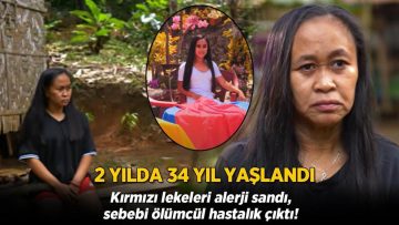 2 senede 34 yıl yaşlandı! Kırmızı lekeleri alerji sandı, sebebi ölümcül çıktı