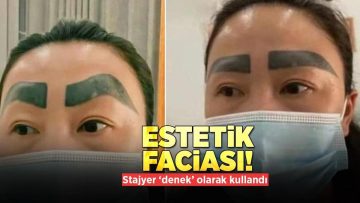 Estetik faciası! Güzel kaş hayali hüsranla sonuçlandı