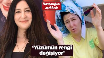 Yasemin Sakallıoğlu hastalığını açıkladı! ‘Yüzümün rengi değişiyor’